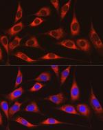 ARMET Polyclonal Antibody