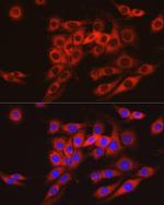 ARMET Antibody in Immunocytochemistry (ICC/IF)