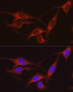 ARMET Antibody in Immunocytochemistry (ICC/IF)