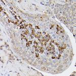 ARMET Antibody in Immunohistochemistry (Paraffin) (IHC (P))