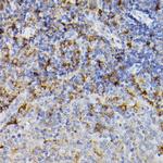 ARMET Antibody in Immunohistochemistry (Paraffin) (IHC (P))