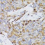 ARMET Antibody in Immunohistochemistry (Paraffin) (IHC (P))