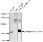 ARMET Antibody in Immunoprecipitation (IP)