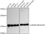ARMET Antibody in Western Blot (WB)