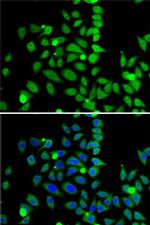 Histone H3 Antibody in Immunocytochemistry (ICC/IF)