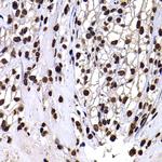 Histone H3 Antibody in Immunohistochemistry (Paraffin) (IHC (P))
