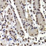 Histone H3 Antibody in Immunohistochemistry (Paraffin) (IHC (P))