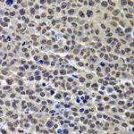 Histone H3 Antibody in Immunohistochemistry (Paraffin) (IHC (P))