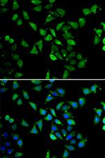 eIF3c Polyclonal Antibody