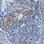 PRC1 Antibody in Immunohistochemistry (Paraffin) (IHC (P))
