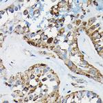 PRC1 Antibody in Immunohistochemistry (Paraffin) (IHC (P))