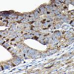 PRC1 Antibody in Immunohistochemistry (Paraffin) (IHC (P))