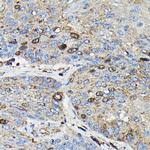 PRC1 Antibody in Immunohistochemistry (Paraffin) (IHC (P))