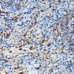 PRC1 Antibody in Immunohistochemistry (Paraffin) (IHC (P))