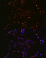 COPB2 Antibody in Immunocytochemistry (ICC/IF)