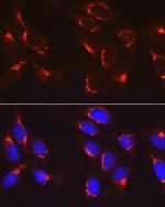 COPB2 Antibody in Immunocytochemistry (ICC/IF)