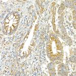 COPB2 Antibody in Immunohistochemistry (Paraffin) (IHC (P))