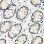 TGM5 Antibody in Immunohistochemistry (Paraffin) (IHC (P))