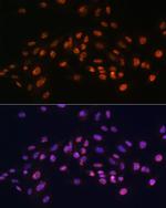 EFTUD2 Antibody in Immunocytochemistry (ICC/IF)