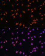 EFTUD2 Polyclonal Antibody