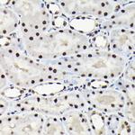 EFTUD2 Antibody in Immunohistochemistry (Paraffin) (IHC (P))