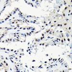 EFTUD2 Antibody in Immunohistochemistry (Paraffin) (IHC (P))