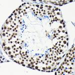 EFTUD2 Antibody in Immunohistochemistry (Paraffin) (IHC (P))