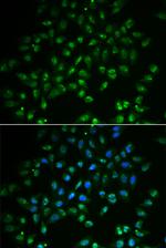 HAND2 Polyclonal Antibody