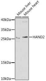 HAND2 Antibody in Western Blot (WB)