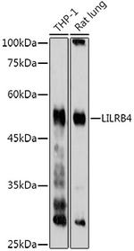 CD85k (Gp49b) Antibody in Western Blot (WB)