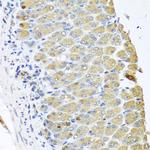 OGFR Antibody in Immunohistochemistry (Paraffin) (IHC (P))