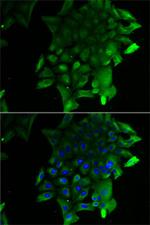 SLA/LP Polyclonal Antibody