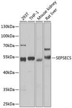 SLA/LP Antibody in Western Blot (WB)