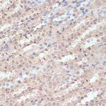 NAA20 Antibody in Immunohistochemistry (Paraffin) (IHC (P))