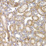 APC5 Antibody in Immunohistochemistry (Paraffin) (IHC (P))