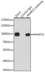 APC5 Antibody in Immunoprecipitation (IP)