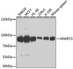 APC5 Antibody in Western Blot (WB)
