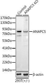 APC5 Antibody in Western Blot (WB)