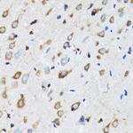 NDE1 Antibody in Immunohistochemistry (Paraffin) (IHC (P))