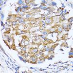 NDE1 Polyclonal Antibody