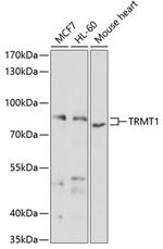 TRMT1 Polyclonal Antibody