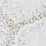 ELAC2 Antibody in Immunohistochemistry (Paraffin) (IHC (P))