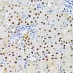 ELAC2 Antibody in Immunohistochemistry (Paraffin) (IHC (P))