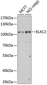 ELAC2 Antibody in Western Blot (WB)