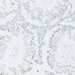 FIP1L1 Antibody in Immunohistochemistry (Paraffin) (IHC (P))