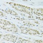 FIP1L1 Antibody in Immunohistochemistry (Paraffin) (IHC (P))