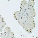 FIP1L1 Antibody in Immunohistochemistry (Paraffin) (IHC (P))