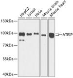 ATRIP Polyclonal Antibody