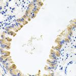 ALKBH8 Antibody in Immunohistochemistry (Paraffin) (IHC (P))