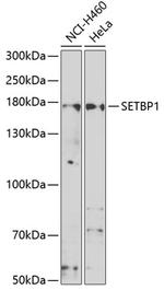 SETBP1 Antibody in Western Blot (WB)